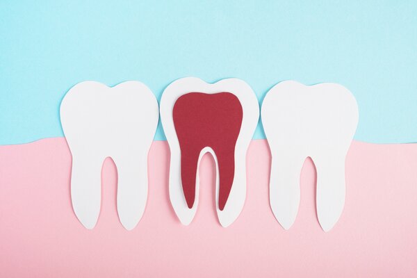 Удаление кисты зуба