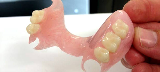 vremennye-zubnye-protezy2