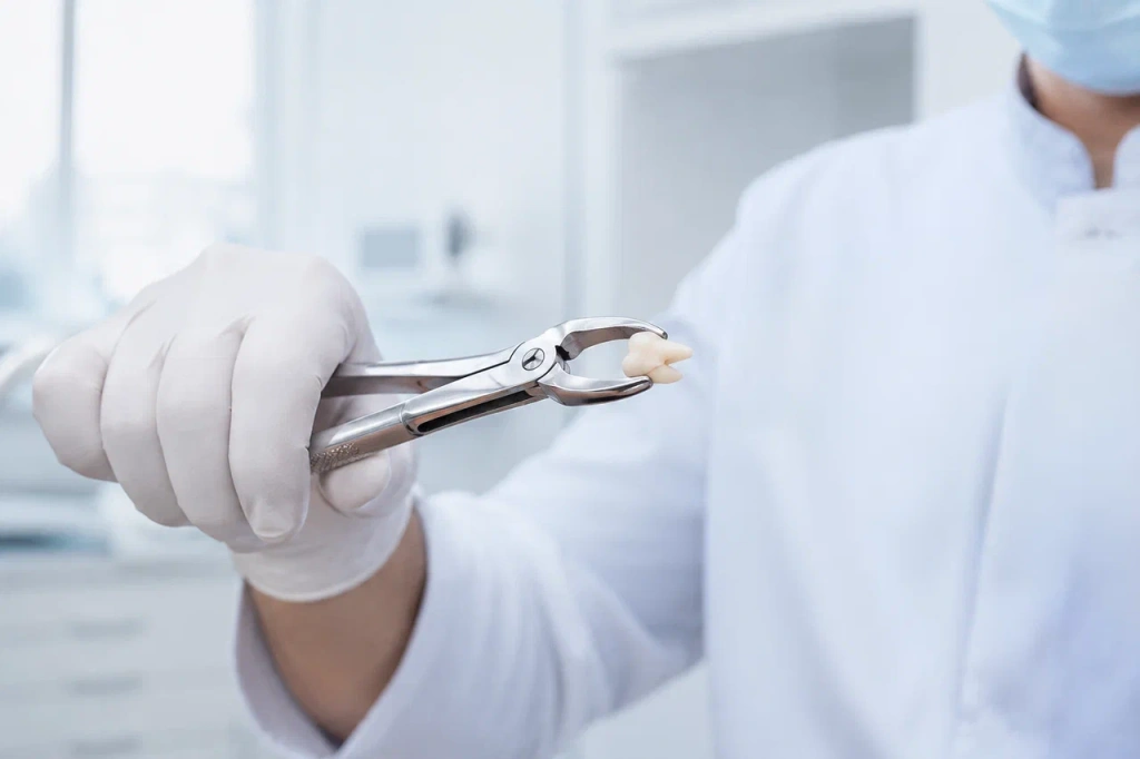 Performing a wisdom tooth extraction