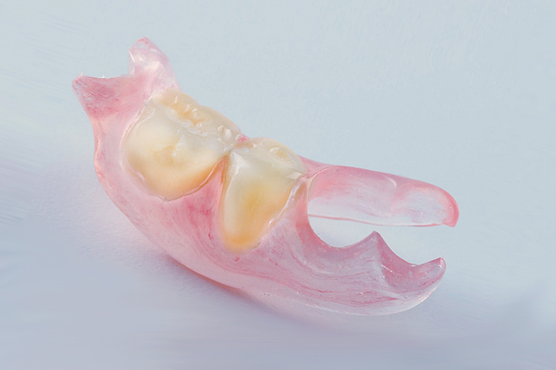 vremennye-zubnye-protezy1
