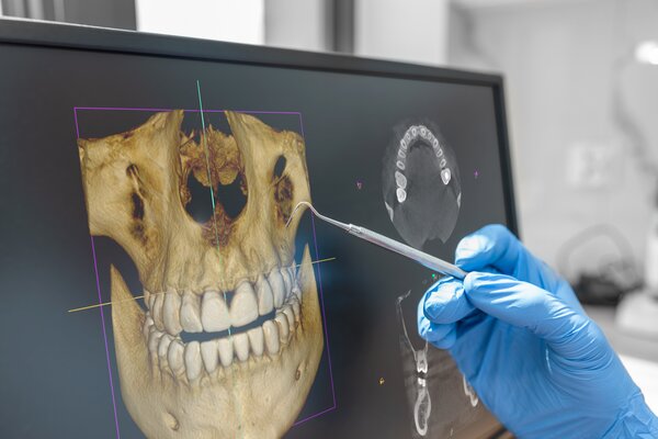 3D снимок зубов