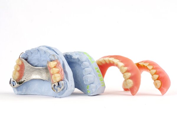Разновидности временных зубных протезов