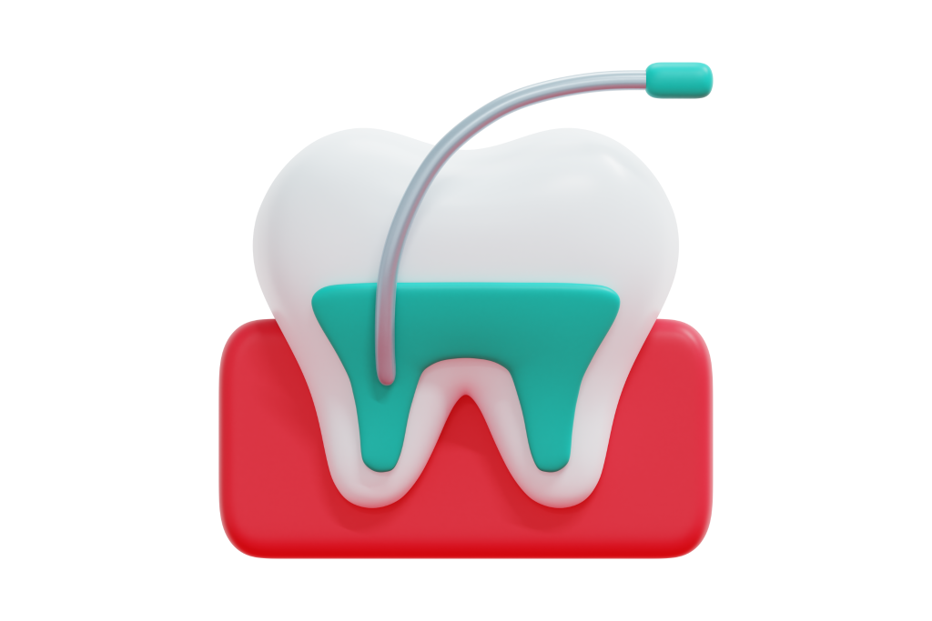 Чего ожидать от перелечивания каналов зуба?