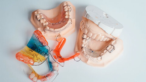 ортодонтические пластины