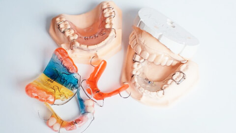 Ортодонтическое лечение с применением съемной техники