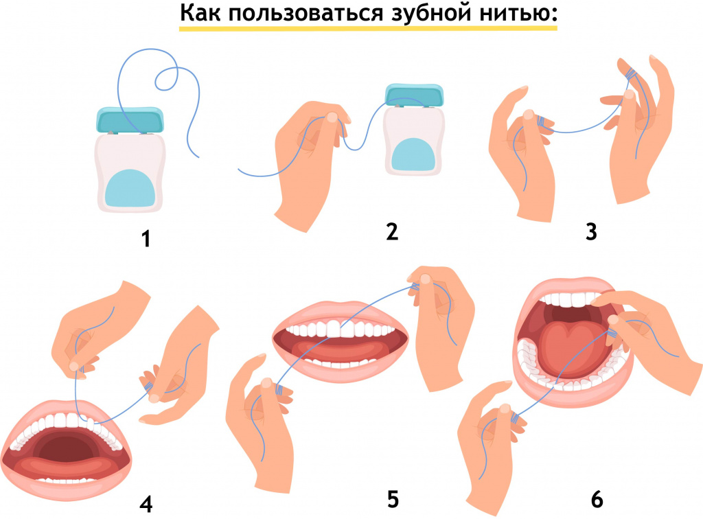 kak_polzovatsya_zubnoy_nitu_9.jpg
